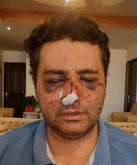 عکس ، ضرب و شتم شدید متخصص بیهوشی توسط همراهان بیمار در پیرانشهر عکس ، ضرب و شتم شدید متخصص بیهوشی توسط همراهان بیمار در پیرانشهر