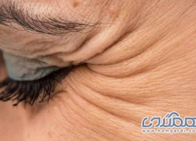 چطور از چین و چروک های پنجه کلاغی جلوگیری کنیم؟